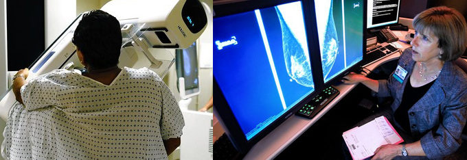 Yearly Mammograms Over Age 40